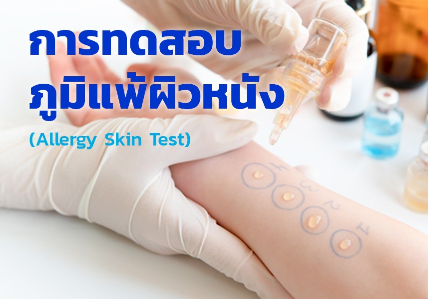 การทดสอบภูมิแพ้ผิวหนัง